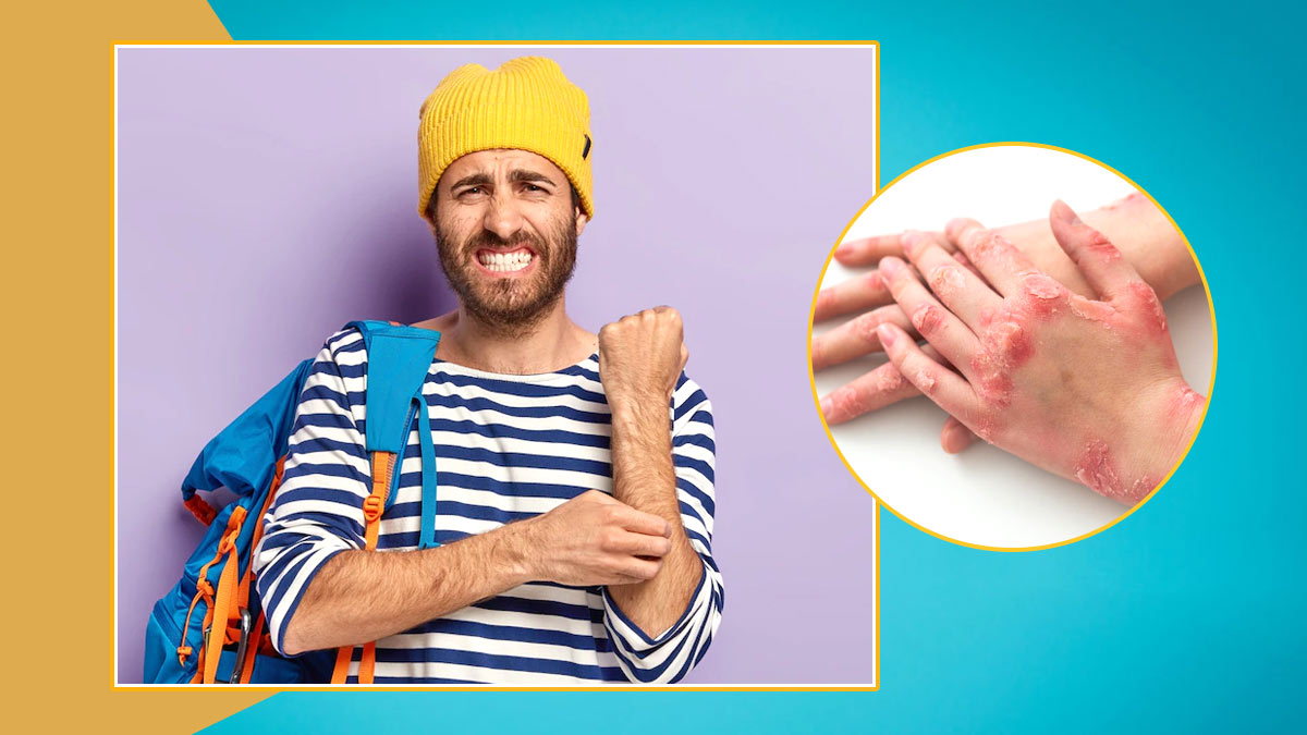When Should You Be Worried About Itchy Skin? Read To Find Out